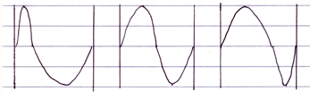 zero crossing modulation.png